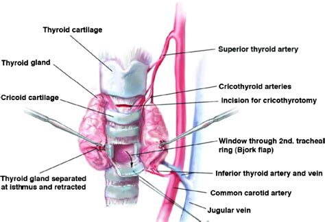 Anatomy For Tracheostomy Anatomical Charts Posters