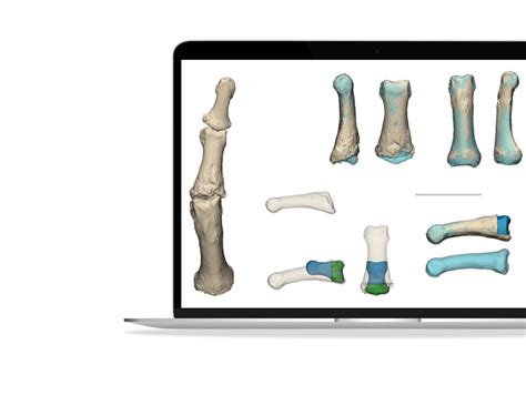 Webinar Sls Printing At The Point Of Care Materialise