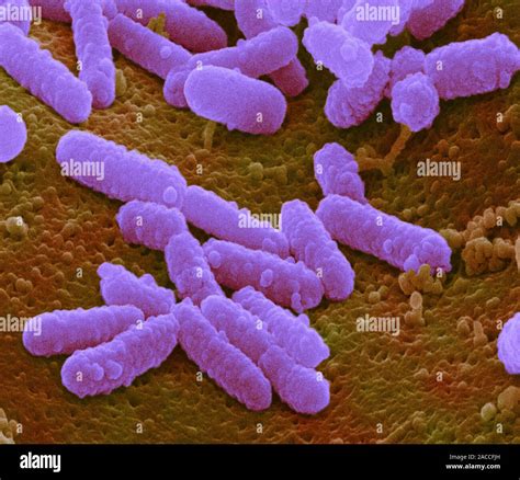 E Coli Bacteria Coloured Scanning Electron Micrograph Sem Of Escherichia Coli E Coli