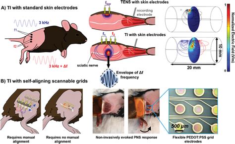 Temporal Interference Nerve Stimulation Tins The Mouse Sciatic Nerve