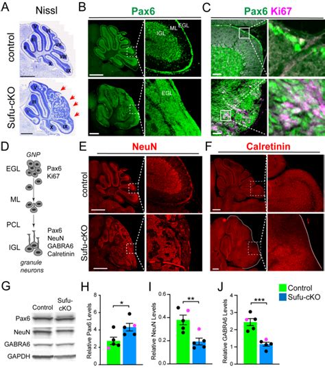 Cerebellar Granule Neuron Precursors Fail To Differentiate And Continue