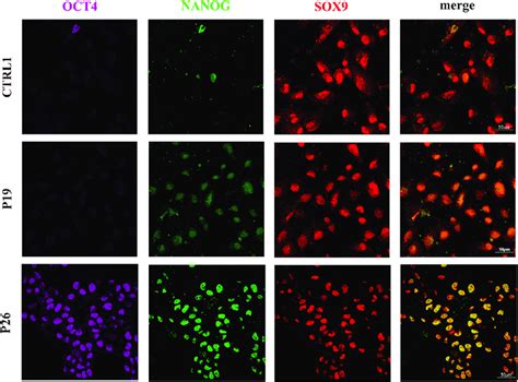 Aberrant NANOG And OCT4 Activity In The Patient Derived CNCC