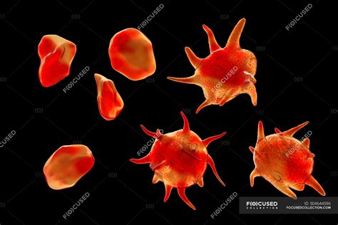 Illustration of platelets (thrombocytes) that have been activated (with extensions) and those ...