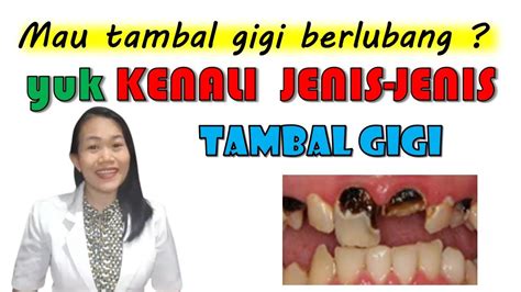 Mau Tambal Gigi Kenali Jenis Jenis Bahan Tambal Gigi Berlubang Berikut