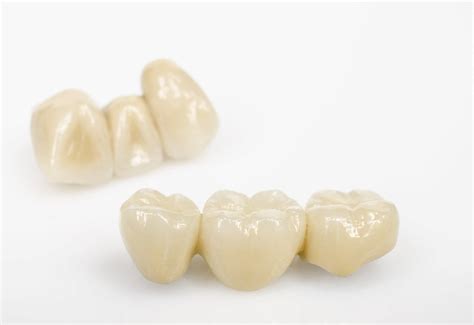 Types of Cosmetic Dental Crowns - Lerner & Lemongello | Cosmetic and ...