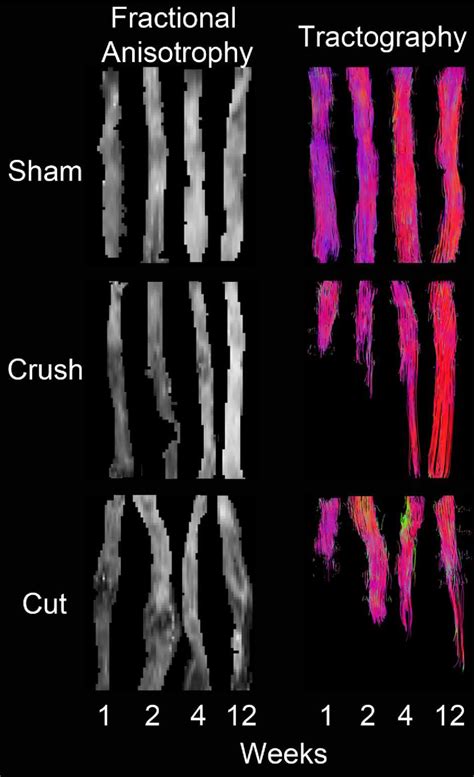 Figure 1 From Diffusion MRI Predicts Peripheral Nerve Recovery In A Rat