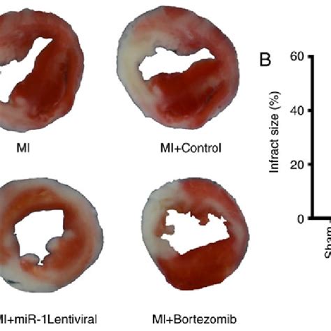 Myocardial Infarct Size In Each Group Representative Illustrations Of