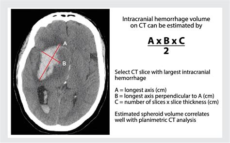 Figure 3 2 From Imaging Of Hemorrhagic Stroke Semantic Scholar