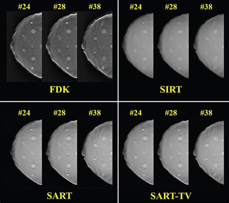 Evaluation Of Reconstruction Algorithms For A Stationary Digital Breast