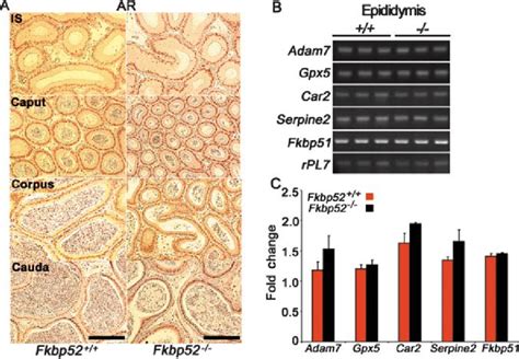 Immunolocalization Of Androgen Receptor Ar And Expression Of