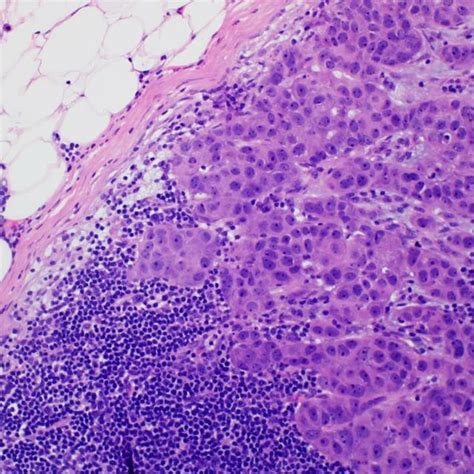 Haematoxylin And Eosin Hande Stain At X200 Magnification Sentinel Download Scientific Diagram