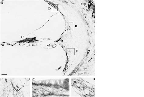 Immunohistochemical Staining Using Pfetin Antibody On Formalin Fixed