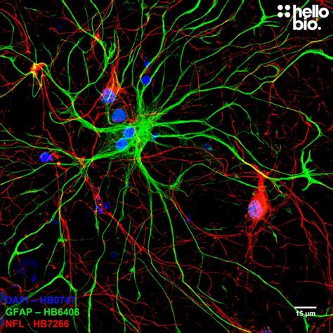 Anti Gfap Antibody Validab™ Astrocyte Marker Chicken Polyclonal