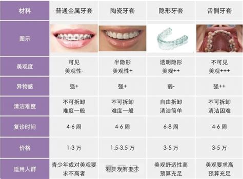 正畸牙套哪种最好看这一张图就够了 看牙记网