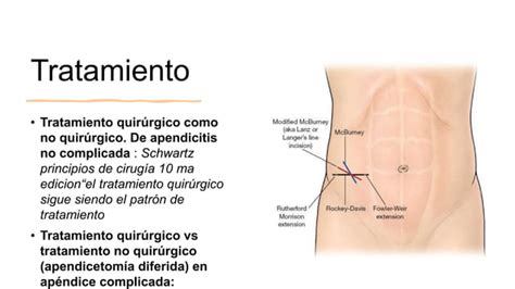 APENDICITIS AGUDA CIRUGIA GENRERAL CLASE PPT