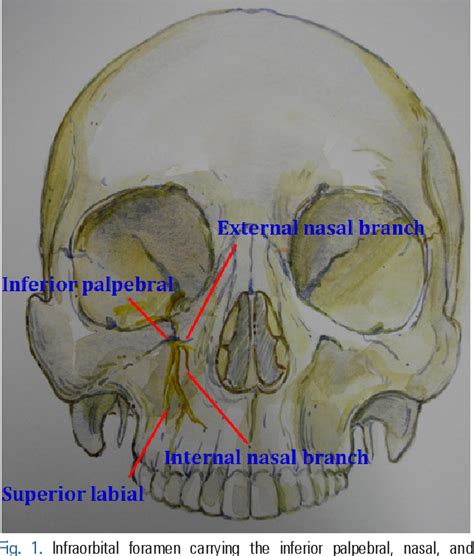 Figure 1 from Accessory infraorbital foramen location using cone-beam ...