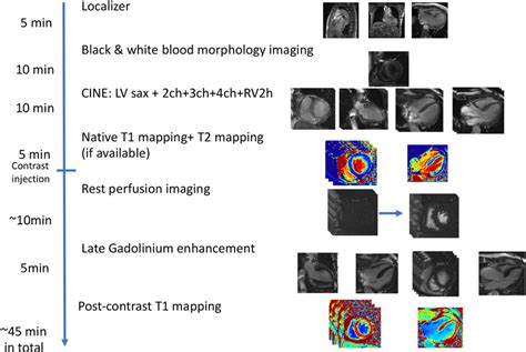 Cardiovascular Magnetic Resonance Imaging Protocol 2ch Two Chamber