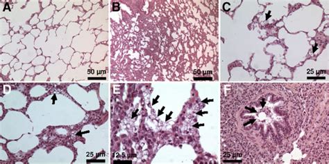 Histological Appearance Of The Lungs In The Different Groups Panel A Download Scientific