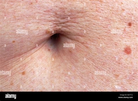 The surface of the stomach skin and navel of the elderly old woman. A ...