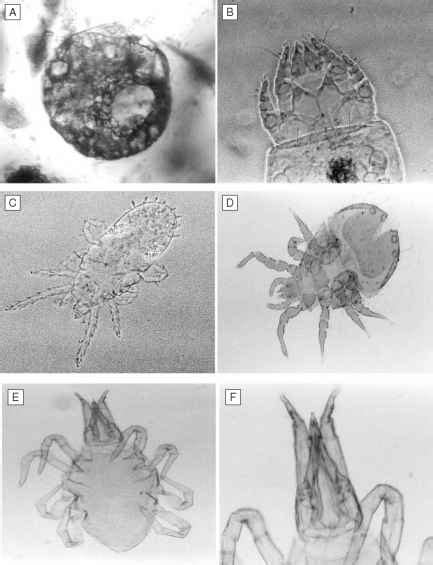 Archamoebae Phylum Amoebozoa Conosa Pelobiontida Soil Solution