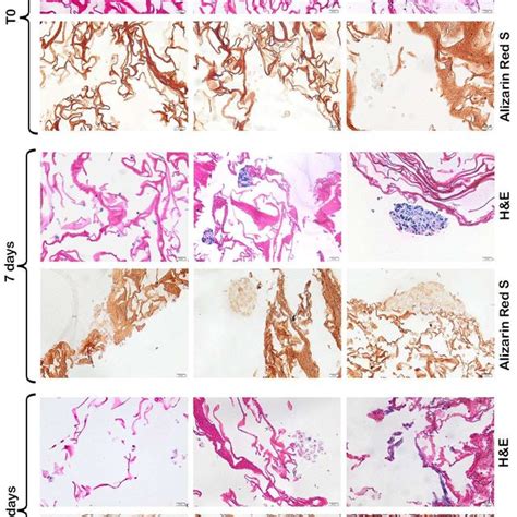 Histological Evaluation Of Osteogenic Differentiation Microtome