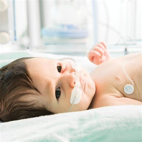 Neonatal Ventilation – Respiratory Care Africa