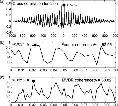 Uterine Contraction Signals—application Of The Linear Synchronization Measures European