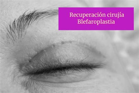 Blefaroplastia recuperación Recomendaciones y Guía 2024