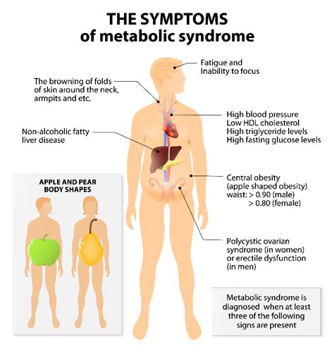 Have You Been Diagnosed With Metabolic Syndrome Uf Ifas Extension