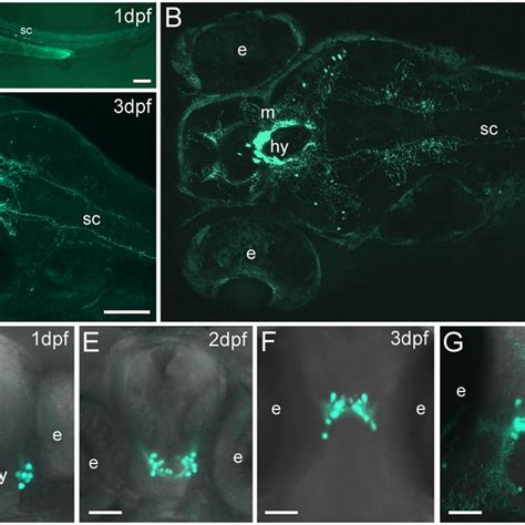 Stable Transgenic Pth4egfp Zebrafish Line Shows Egfp Expressing Cells