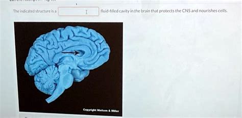 Solved The Indicated Structure Is A Fluid Filled Cavity In The Brain