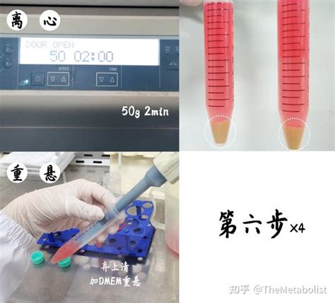 代谢学人 小鼠原代肝细胞提取之实操篇 知乎