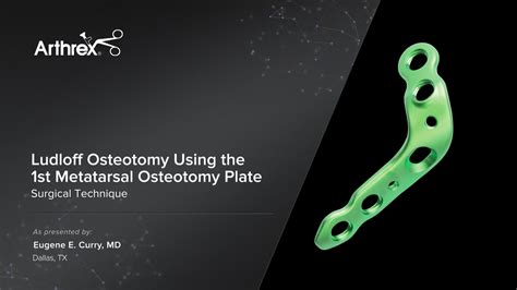 Arthrex Ludloff Osteotomy Using The St Metatarsal Osteotomy Plate