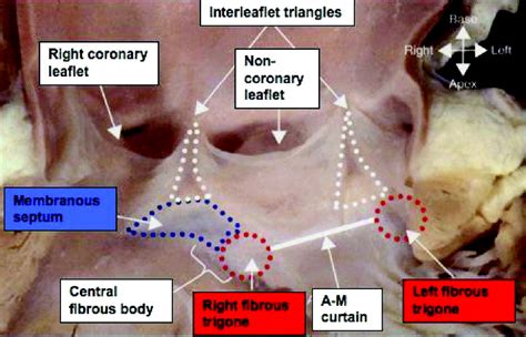 Aortic Valve Anatomy Diagram