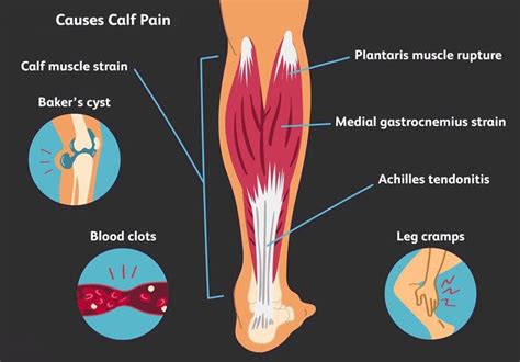 Calf Muscle Tightness and Injury