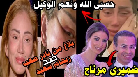 مفاجات يكشفها دكتور نادر صعب بعد تشوه وجه ريهام سعيد Youtube