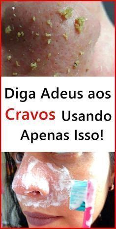 Receita Simples Para Remover Cravos Do Rosto Natural Care Perfect