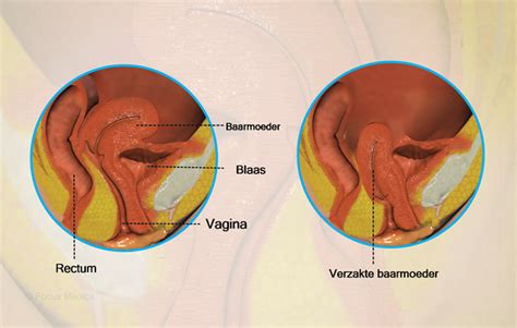 Health Condition Symptoms Causes Treatment And More