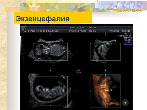 Пренатальная диагностика - презентация онлайн