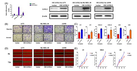 【文献解读】m6a 识别蛋白ythdf3通过loxl3调节黑色素瘤转移新闻动态上海京房生物科技有限公司 苏州京脉生物科技有限公司