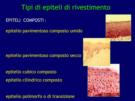 Epitelio Di Transizione 9