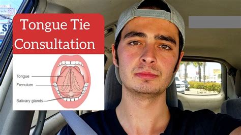 Tongue Tie Surgery Consultation Youtube