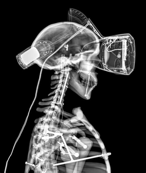 Incredible X Rays Of The Technology We Use On A Daily Basis