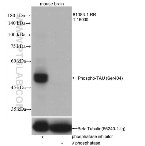 Phospho Tau Ser Antibody Rr Proteintech