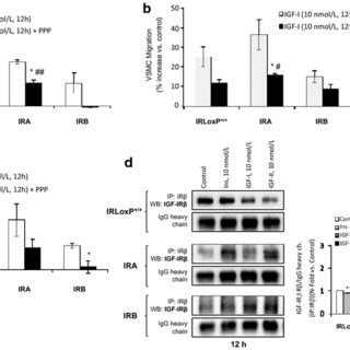 Insulin Induces Migration In IRA VSMCs A Analysis Of Basal Migration