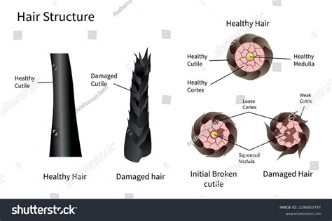 Hair Growth Cycle Anagen Catagen Telogen Stock Vector (Royalty Free ...