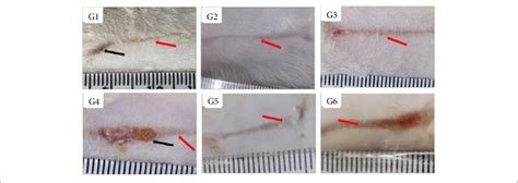 Macroscopic Aspects Of Partial Thickness Burn Wounds Experimentally