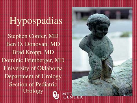 PPT - Hypospadias PowerPoint Presentation, free download - ID:9136397