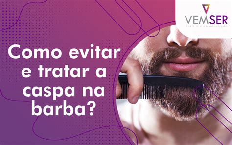 Como Evitar E Tratar A Caspa Na Barba Vemser Cursos