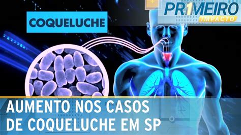 Cidade de São Paulo registra aumento nos casos de coqueluche em 2024